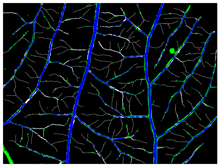 Exemplo de segmentacao de vasos sanguineos